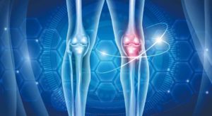 RETURN TO SPORT AFTER ACL INJURY