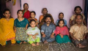 Achondroplasia
